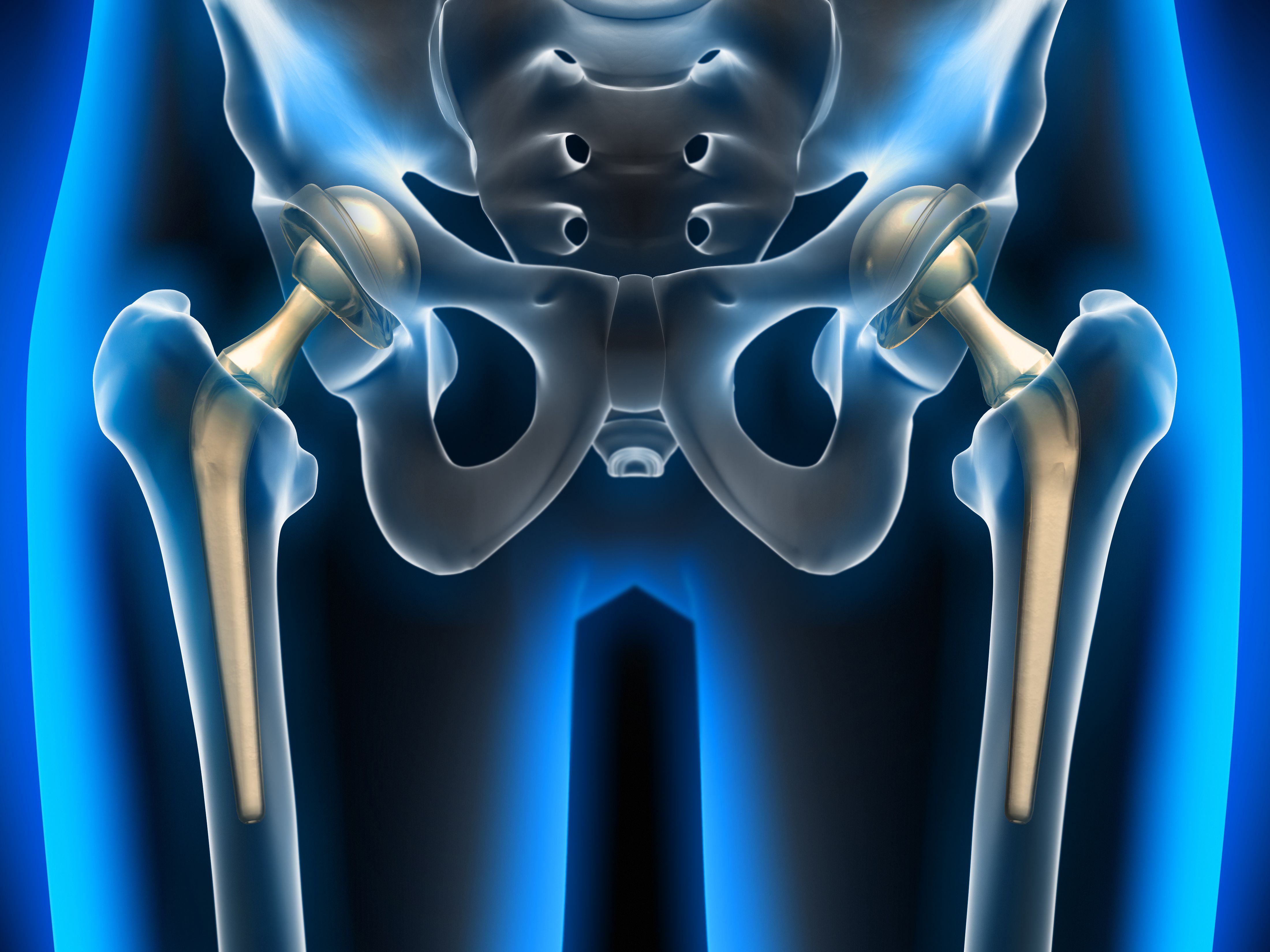 procedure  replacement surgery